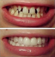 Стоматолог, имплантация зубов в Праге