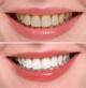Услуги стоматолога: лечение, чистка, протезирование зубов
